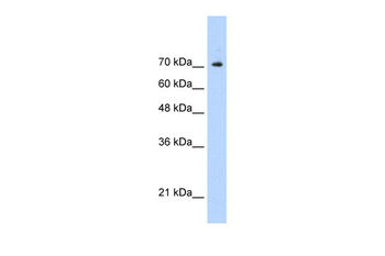 STAT1 Rabbit Polyclonal Antibody