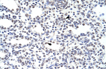 ILF3 Rabbit Polyclonal Antibody