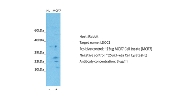 LDOC1 Rabbit Polyclonal Antibody