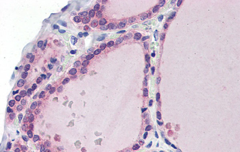 LDOC1 Rabbit Polyclonal Antibody