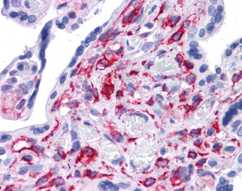 STAT5B Rabbit Polyclonal Antibody