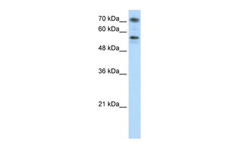 BRD7 Rabbit Polyclonal Antibody