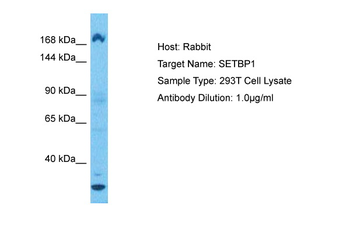 SETBP1 Rabbit Polyclonal Antibody