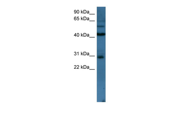 TLX2 Rabbit Polyclonal Antibody