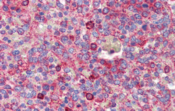 BCL11A Rabbit Polyclonal Antibody