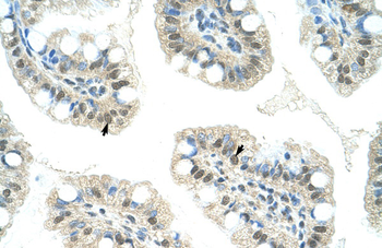 JMJD2D Rabbit Polyclonal Antibody