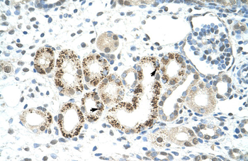 JMJD2D Rabbit Polyclonal Antibody
