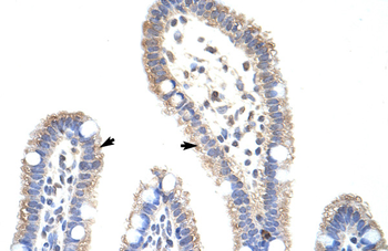 METTL3 Rabbit Polyclonal Antibody