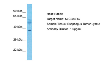 SLC2A4RG Rabbit Polyclonal Antibody