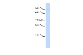 PRDM13 Rabbit Polyclonal Antibody