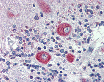 GRHL2 Rabbit Polyclonal Antibody