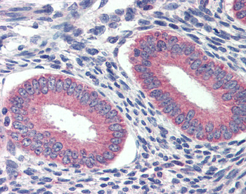 GRHL2 Rabbit Polyclonal Antibody