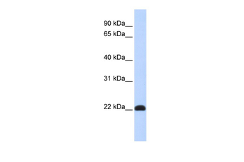 KLF16 Rabbit Polyclonal Antibody