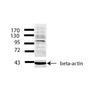 PML Rabbit Polyclonal Antibody