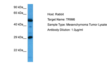 TRIM6 Rabbit Polyclonal Antibody