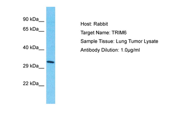 TRIM6 Rabbit Polyclonal Antibody