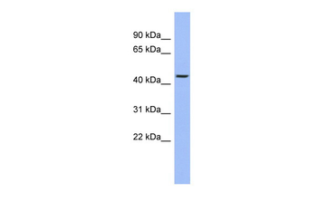 TRIOBP Rabbit Polyclonal Antibody