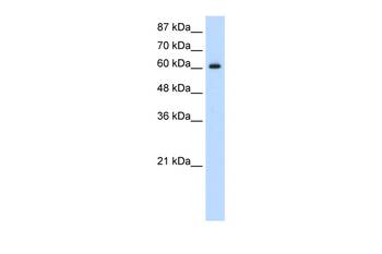 HIF3A Rabbit Polyclonal Antibody