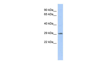 DLX1 Rabbit Polyclonal Antibody