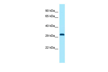 Dlx1 Rabbit Polyclonal Antibody