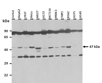 FOXK2 Rabbit Polyclonal Antibody