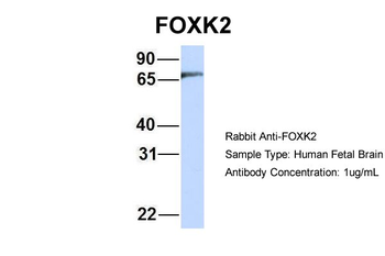 FOXK2 Rabbit Polyclonal Antibody
