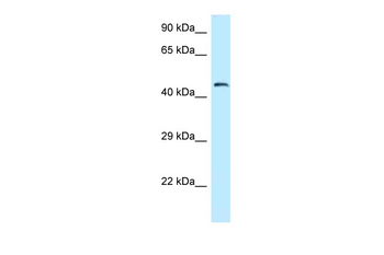 Kat5 Rabbit Polyclonal Antibody