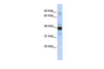 RNF34 Rabbit Polyclonal Antibody