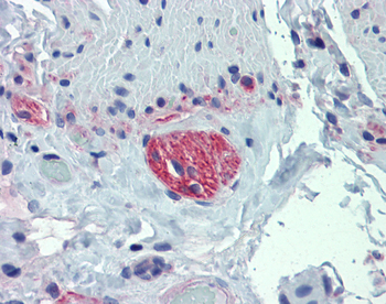 TUBB2A Rabbit Polyclonal Antibody