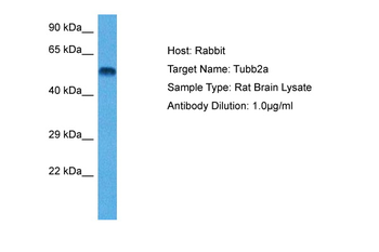 TUBB2A Rabbit Polyclonal Antibody