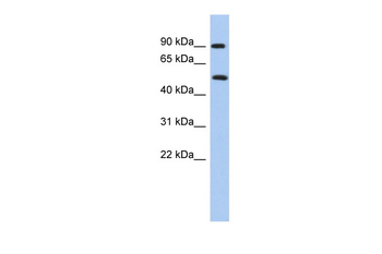 PRMT7 Rabbit Polyclonal Antibody