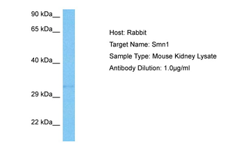 SMN1 Rabbit Polyclonal Antibody