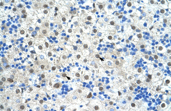 SF3B1 Rabbit Polyclonal Antibody