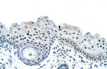 SF3B1 Rabbit Polyclonal Antibody