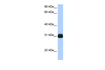 RBPMS Rabbit Polyclonal Antibody