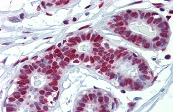 FUS Rabbit Polyclonal Antibody