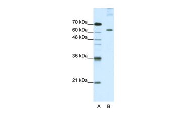 PUM3 Rabbit Polyclonal Antibody
