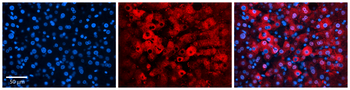 EIF4G2 Rabbit Polyclonal Antibody
