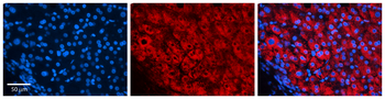 EIF4G2 Rabbit Polyclonal Antibody