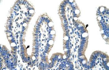 FBL Rabbit Polyclonal Antibody