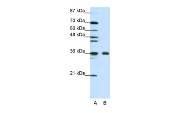 FBL Rabbit Polyclonal Antibody