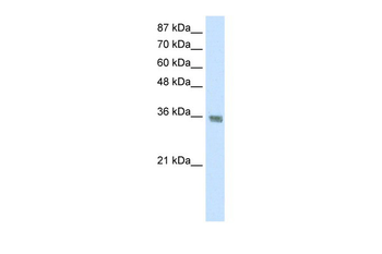HNRPA1 Rabbit Polyclonal Antibody