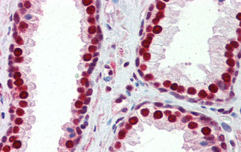 SSB Rabbit Polyclonal Antibody