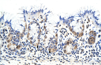 PRKRA Rabbit Polyclonal Antibody