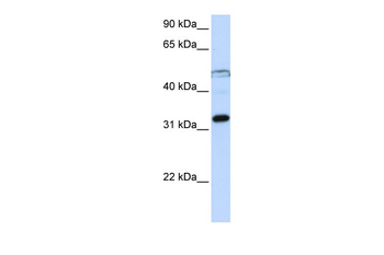 EIF3G Rabbit Polyclonal Antibody