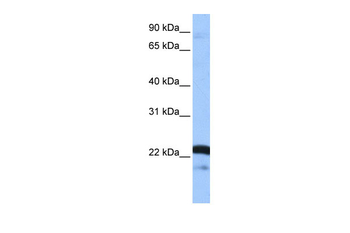 SFRS9 Rabbit Polyclonal Antibody