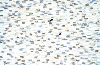 ILF3 Rabbit Polyclonal Antibody