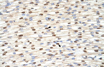 ILF3 Rabbit Polyclonal Antibody