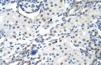 SNRPA Rabbit Polyclonal Antibody