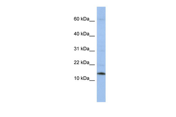 SNRPD2 Rabbit Polyclonal Antibody